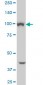 VPS11 Antibody (monoclonal) (M01)