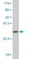 VPS18 Antibody (monoclonal) (M01)