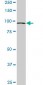 VPS18 Antibody (monoclonal) (M01)