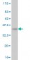 VPS18 Antibody (monoclonal) (M02)