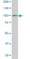 VPS18 Antibody (monoclonal) (M02)