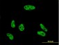 VPS72 Antibody (monoclonal) (M01)