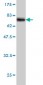 VPS72 Antibody (monoclonal) (M01)