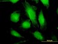 WARS Antibody (monoclonal) (M02)