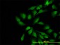 WASL Antibody (monoclonal) (M04)