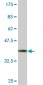 WBSCR1 Antibody (monoclonal) (M07)
