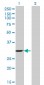 WBSCR1 Antibody (monoclonal) (M07)
