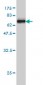 WDR77 Antibody (monoclonal) (M01)