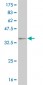 WT1 Antibody (monoclonal) (M01)
