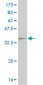 WT1 Antibody (monoclonal) (M01)