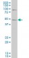 WT1 Antibody (monoclonal) (M01)