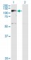 XPO5 Antibody (monoclonal) (M01)