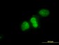 XRCC6 Antibody (monoclonal) (M05)