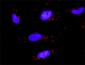 ZBTB16 Antibody (monoclonal) (M01)
