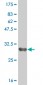 ZDHHC8 Antibody (monoclonal) (M02)