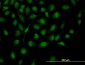 ZHX2 Antibody (monoclonal) (M01)