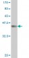 ZHX2 Antibody (monoclonal) (M01)