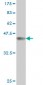 ZHX2 Antibody (monoclonal) (M01)