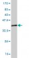 ZIC1 Antibody (monoclonal) (M01)
