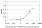 ZIC1 Antibody (monoclonal) (M03)