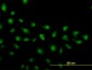 ZIC4 Antibody (monoclonal) (M01)