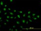 ZIC4 Antibody (monoclonal) (M01)