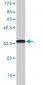 ZIC4 Antibody (monoclonal) (M01)