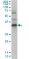 ZIC4 Antibody (monoclonal) (M01)
