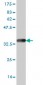 ZIC4 Antibody (monoclonal) (M05)