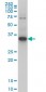 ZIC4 Antibody (monoclonal) (M05)