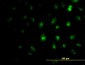 ZIC4 Antibody (monoclonal) (M06)