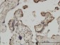 ZIC4 Antibody (monoclonal) (M06)