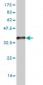 ZIC4 Antibody (monoclonal) (M06)