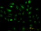 ZIC4 Antibody (monoclonal) (M07)