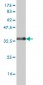 ZIC4 Antibody (monoclonal) (M07)