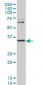 ZIC4 Antibody (monoclonal) (M07)