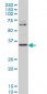 ZIC4 Antibody (monoclonal) (M07)
