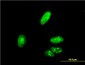 ZIC4 Antibody (monoclonal) (M09)