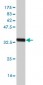 ZIC4 Antibody (monoclonal) (M09)