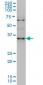 ZIC4 Antibody (monoclonal) (M09)