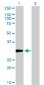 ZNF174 Antibody (monoclonal) (M01)