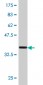 ZNF18 Antibody (monoclonal) (M01)