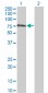 ZNF18 Antibody (monoclonal) (M01)