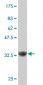 ZNF207 Antibody (monoclonal) (M03)