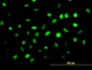 ZNF24 Antibody (monoclonal) (M02)