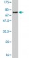 ZNF24 Antibody (monoclonal) (M03)