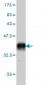 ZNF265 Antibody (monoclonal) (M01)