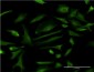 ZNF274 Antibody (monoclonal) (M01)