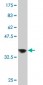 ZNF274 Antibody (monoclonal) (M01)