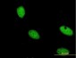 ZNF274 Antibody (monoclonal) (M04)